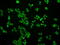 SATB Homeobox 1 antibody, GTX83684, GeneTex, Immunofluorescence image 