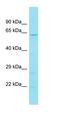 ATP11A Upstream Neighbor antibody, orb326938, Biorbyt, Western Blot image 