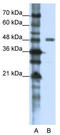 Nuclear inhibitor of protein phosphatase 1 antibody, TA343798, Origene, Western Blot image 
