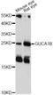 Guanylate Cyclase Activator 1B antibody, LS-C749721, Lifespan Biosciences, Western Blot image 