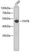 Farnesyltransferase, CAAX Box, Beta antibody, 23-706, ProSci, Western Blot image 