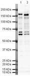 SWI/SNF Related, Matrix Associated, Actin Dependent Regulator Of Chromatin Subfamily C Member 2 antibody, PA5-19831, Invitrogen Antibodies, Western Blot image 
