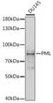 Promyelocytic Leukemia antibody, GTX55751, GeneTex, Western Blot image 