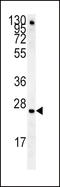 Insulin Like Growth Factor Binding Protein 4 antibody, LS-C165149, Lifespan Biosciences, Western Blot image 