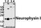 Oxytocin/Neurophysin I Prepropeptide antibody, A01545, Boster Biological Technology, Western Blot image 