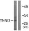 Troponin I3, Cardiac Type antibody, LS-C117721, Lifespan Biosciences, Western Blot image 