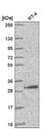 AMMECR1 Like antibody, NBP2-58193, Novus Biologicals, Western Blot image 