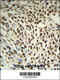 Small Nuclear Ribonucleoprotein D3 Polypeptide antibody, 63-872, ProSci, Immunohistochemistry paraffin image 