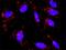 CAMP Responsive Element Binding Protein 3 Like 4 antibody, H00148327-M01, Novus Biologicals, Proximity Ligation Assay image 