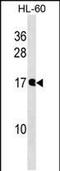 Nudix Hydrolase 10 antibody, PA5-49006, Invitrogen Antibodies, Western Blot image 