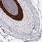 Keratin 25 antibody, HPA058943, Atlas Antibodies, Immunohistochemistry frozen image 