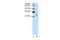 Defective In Cullin Neddylation 1 Domain Containing 1 antibody, 29-776, ProSci, Western Blot image 