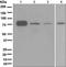 Bradykinin Receptor B2 antibody, ab134118, Abcam, Western Blot image 
