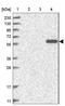 Glutamic--Pyruvic Transaminase antibody, NBP1-89110, Novus Biologicals, Western Blot image 