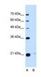 Transmembrane P24 Trafficking Protein 3 antibody, orb330495, Biorbyt, Western Blot image 