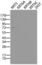 Keratin 5 antibody, LS-C175344, Lifespan Biosciences, Western Blot image 