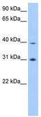 Eukaryotic Translation Initiation Factor 3 Subunit H antibody, TA339679, Origene, Western Blot image 