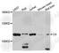 Complement C5 antibody, A8104, ABclonal Technology, Western Blot image 