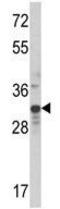 MAX Dimerization Protein MLX antibody, GTX81125, GeneTex, Western Blot image 