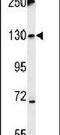 Tankyrase 2 antibody, PA5-25233, Invitrogen Antibodies, Western Blot image 