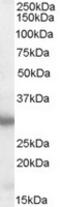 Engrailed Homeobox 2 antibody, TA303085, Origene, Western Blot image 