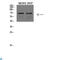 Protein Phosphatase 1 Regulatory Subunit 15A antibody, LS-C813857, Lifespan Biosciences, Western Blot image 