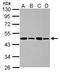 Protein Phosphatase Methylesterase 1 antibody, GTX102660, GeneTex, Western Blot image 