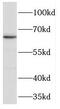 Tripeptidyl Peptidase 1 antibody, FNab08894, FineTest, Western Blot image 