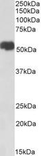 Ferroportin-1 antibody, STJ73127, St John