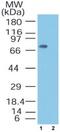 Metastasis Associated 1 Family Member 2 antibody, PA1-41581, Invitrogen Antibodies, Western Blot image 