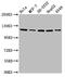 Ubiquitin Specific Peptidase 48 antibody, CSB-PA774808LA01HU, Cusabio, Western Blot image 