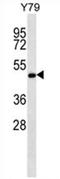 Zinc Finger FYVE-Type Containing 19 antibody, AP54652PU-N, Origene, Western Blot image 