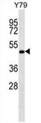 Zinc Finger FYVE-Type Containing 19 antibody, AP54652PU-N, Origene, Western Blot image 