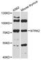 Neurotrophic Receptor Tyrosine Kinase 2 antibody, STJ114207, St John