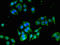 Endothelin B receptor antibody, CSB-PA007404LA01HU, Cusabio, Immunofluorescence image 