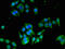 Endothelin Receptor Type B antibody, CSB-PA007404LA01HU, Cusabio, Immunofluorescence image 