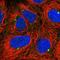 Transmembrane Protein 170B antibody, HPA055134, Atlas Antibodies, Immunofluorescence image 