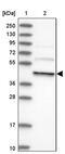 Dynactin Subunit 4 antibody, PA5-58214, Invitrogen Antibodies, Western Blot image 