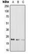 RAB39A, Member RAS Oncogene Family antibody, orb215572, Biorbyt, Western Blot image 