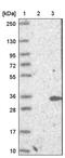 Steroidogenic Acute Regulatory Protein antibody, PA5-54857, Invitrogen Antibodies, Western Blot image 