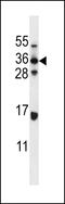ELOVL Fatty Acid Elongase 5 antibody, 56-674, ProSci, Western Blot image 