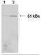 Heterogeneous Nuclear Ribonucleoprotein K antibody, orb109167, Biorbyt, Western Blot image 