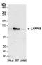 La Ribonucleoprotein Domain Family Member 4B antibody, A304-622A, Bethyl Labs, Western Blot image 
