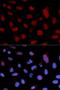 Telomerase Reverse Transcriptase antibody, orb136401, Biorbyt, Immunocytochemistry image 