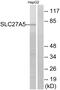 Bile acyl-CoA synthetase antibody, A30575, Boster Biological Technology, Western Blot image 