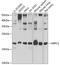 Actin Related Protein 2/3 Complex Subunit 3 antibody, GTX65831, GeneTex, Western Blot image 