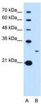 Tetraspanin 15 antibody, TA341909, Origene, Western Blot image 