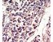 Neurotrophic Receptor Tyrosine Kinase 3 antibody, F50685-0.4ML, NSJ Bioreagents, Immunohistochemistry paraffin image 