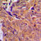 Checkpoint Kinase 1 antibody, GTX56248, GeneTex, Immunohistochemistry paraffin image 