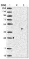 Poly(ADP-Ribose) Polymerase Family Member 11 antibody, PA5-55456, Invitrogen Antibodies, Western Blot image 